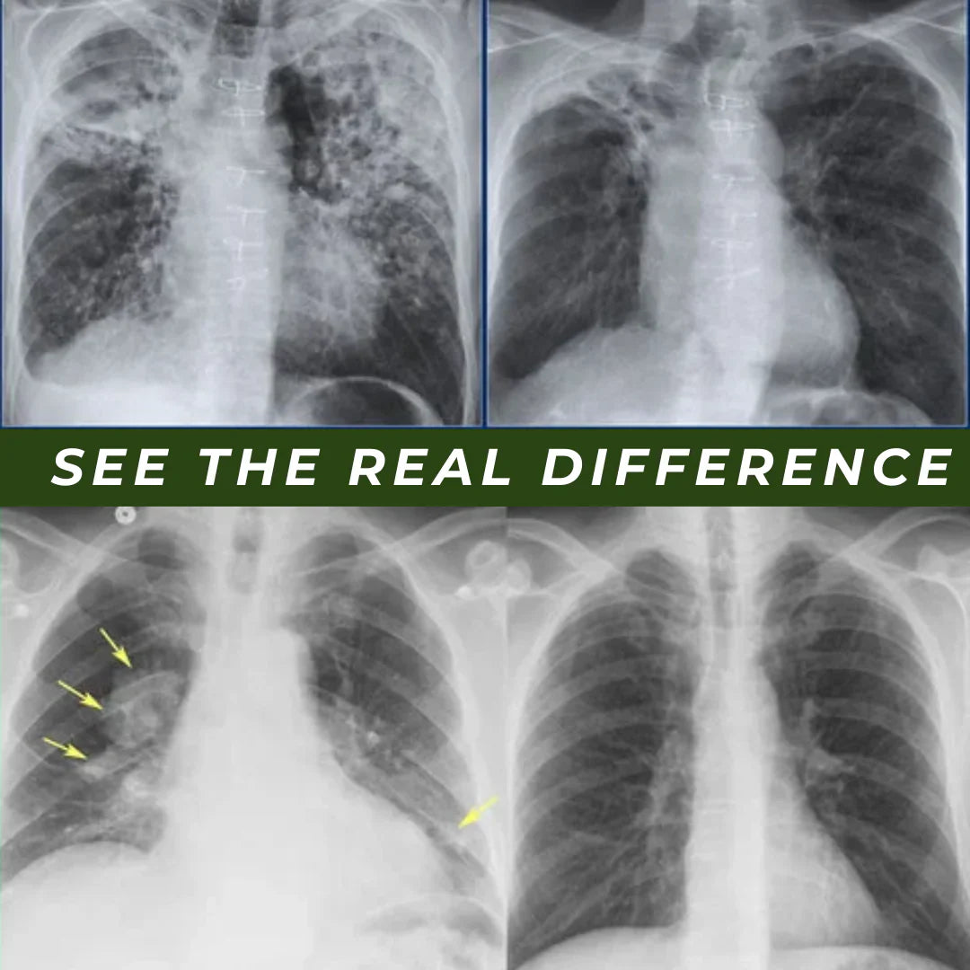 Calm Your Chest, Calm