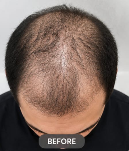 Before