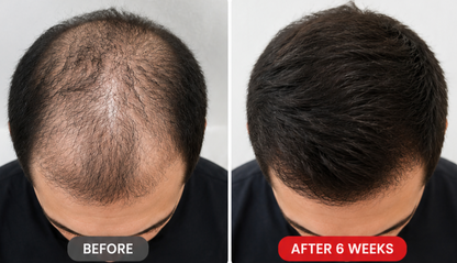 Hair Growth Therapy Cap